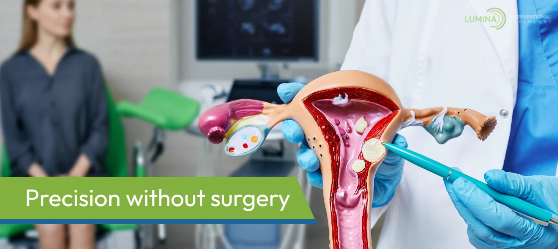 Doctor pointing at uterus model to explain fibroid treatment procedure.